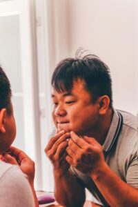 菌活サプリがニキビ改善にどのように役立つのか？
